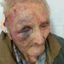 Криминално проявен циганин преби самотно живеещ старец (снимки +18)